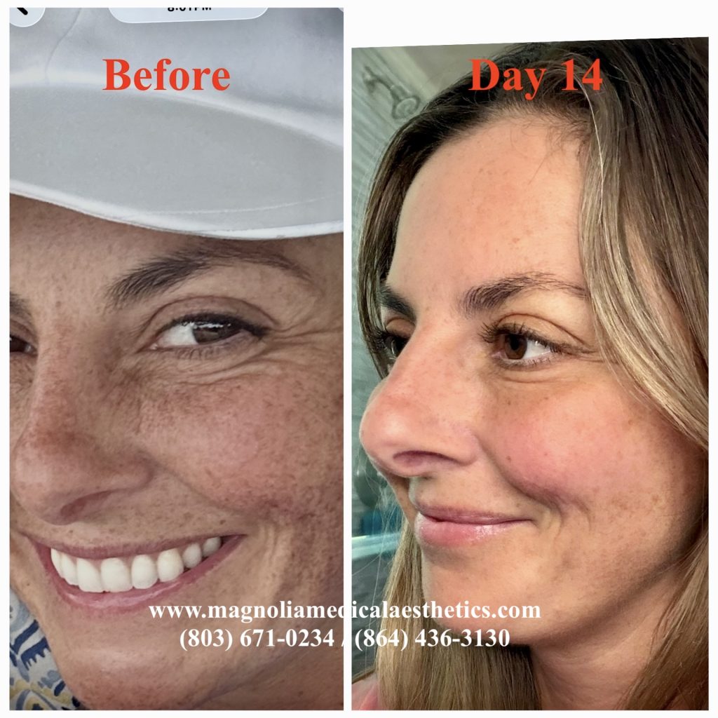 Solaria Results Magnolia Medical Aesthetics