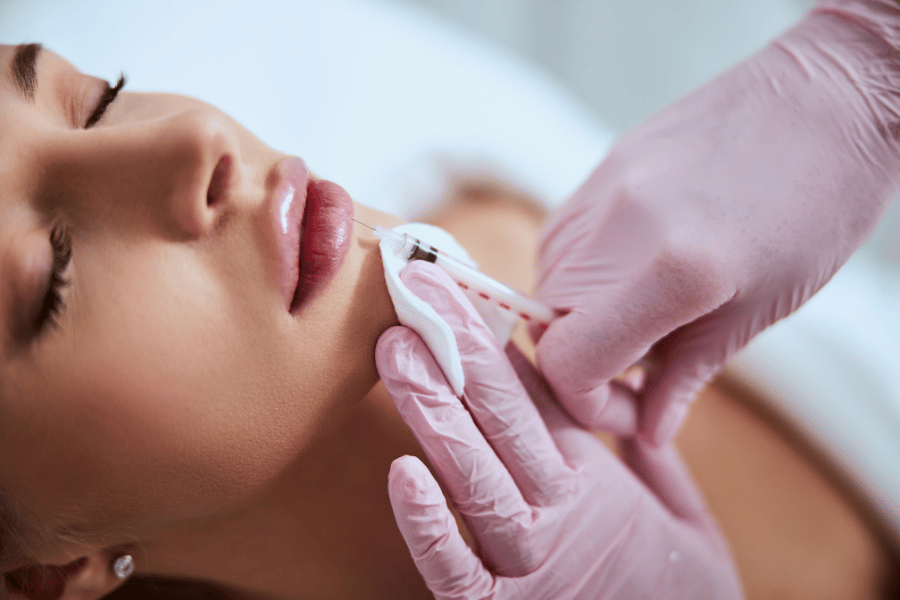 What to Know Before Getting Lip Filler